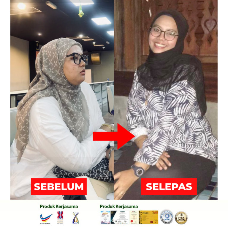 before-after-768x768